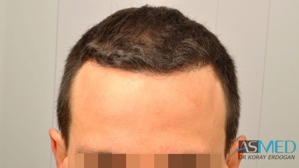 Patient Result