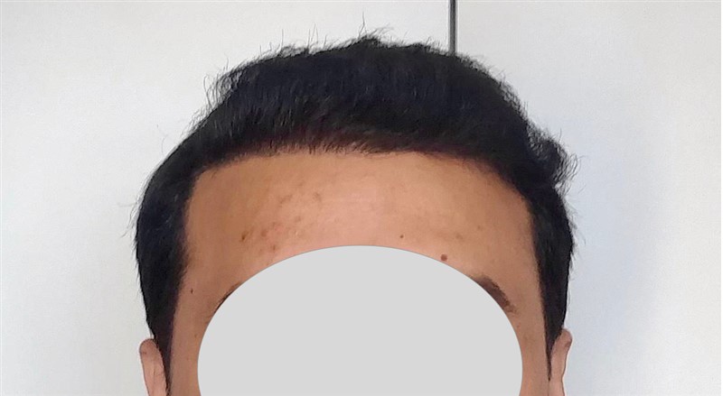 Patient Result