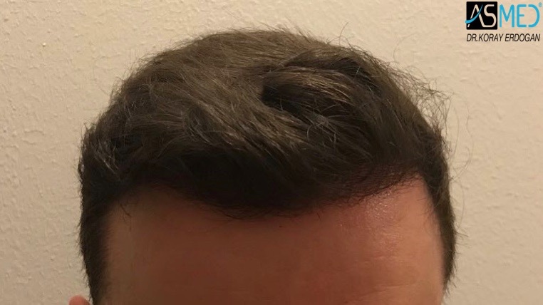 Patient Result