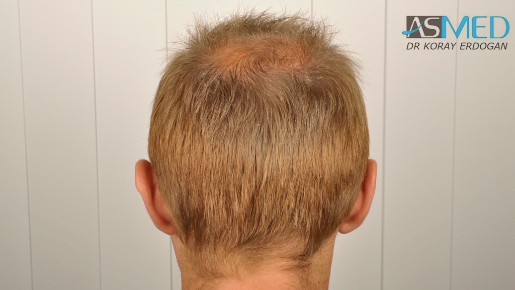 Gallery Image 0