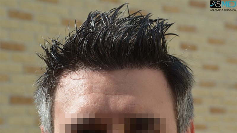Patient Result