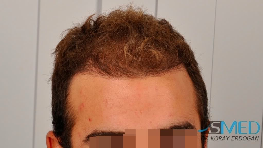 Patient Result