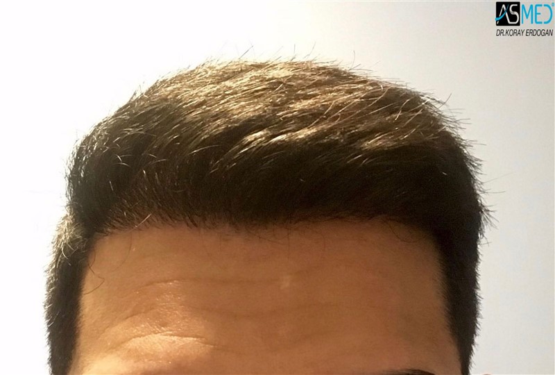 Patient Result