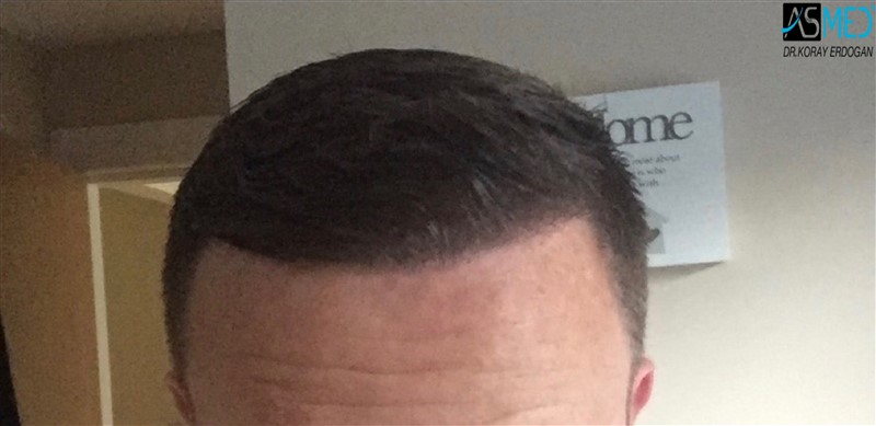 Patient Result