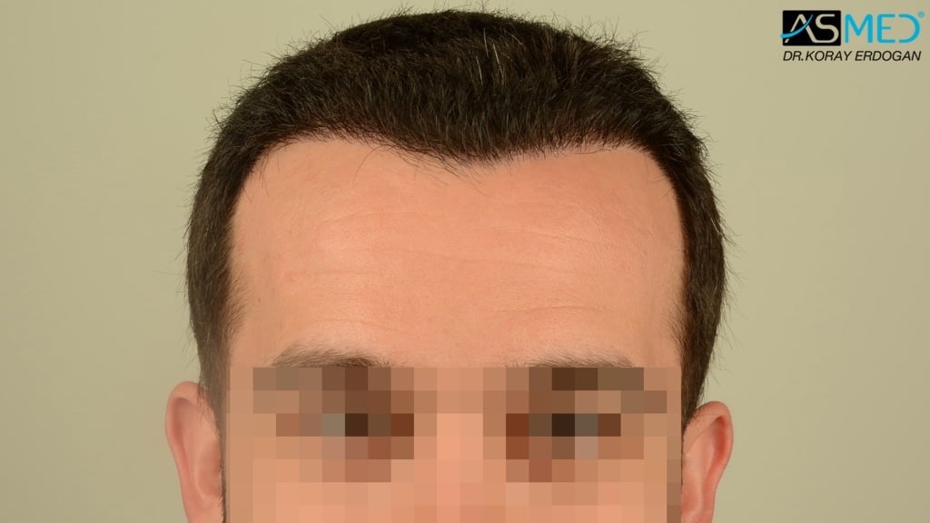 Patient Result