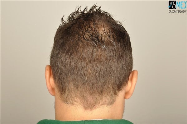 Gallery Image 0