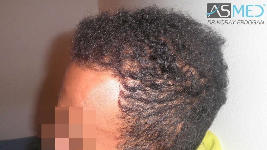 Before