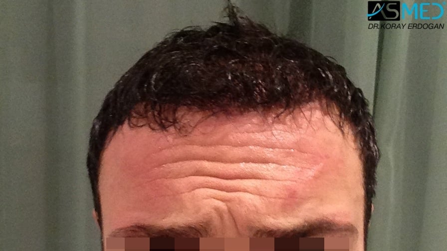 Before