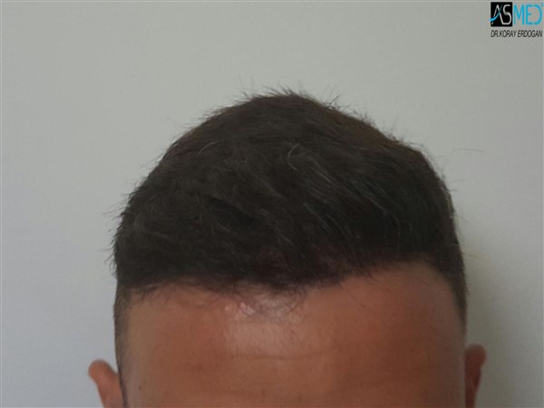 Patient Result