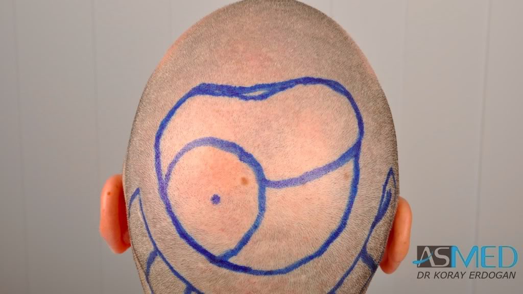 Gallery Image 0