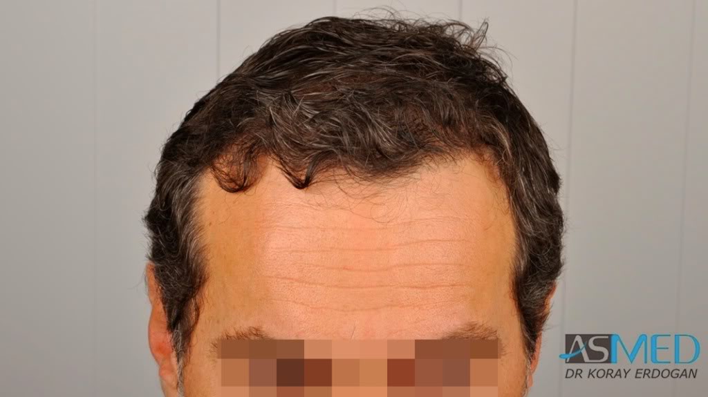 Patient Result