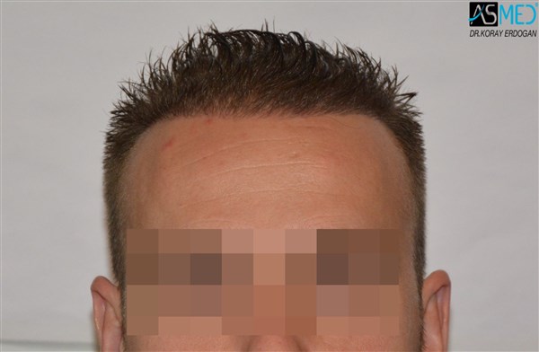 Patient Result