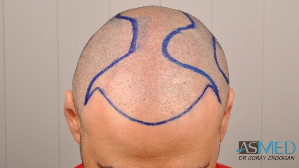 Gallery Image 0