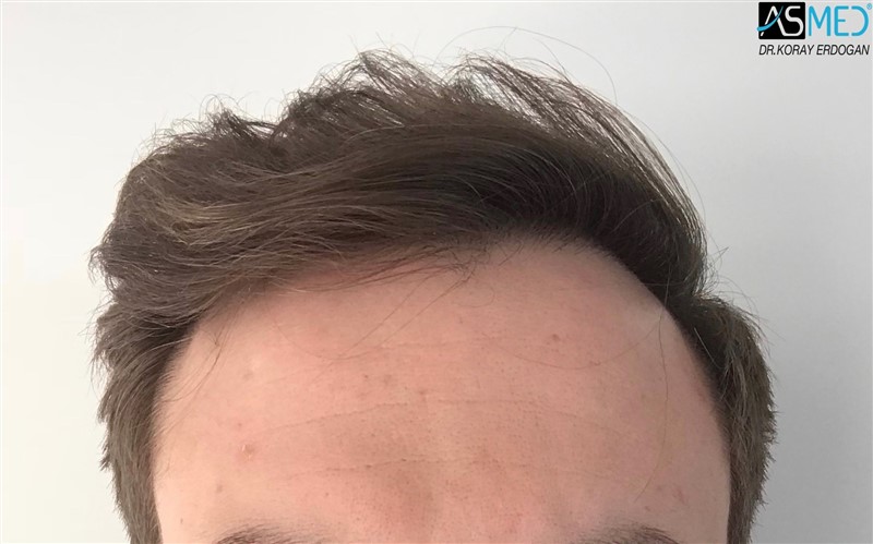 Patient Result