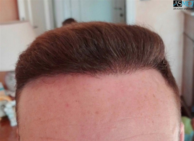 Patient Result