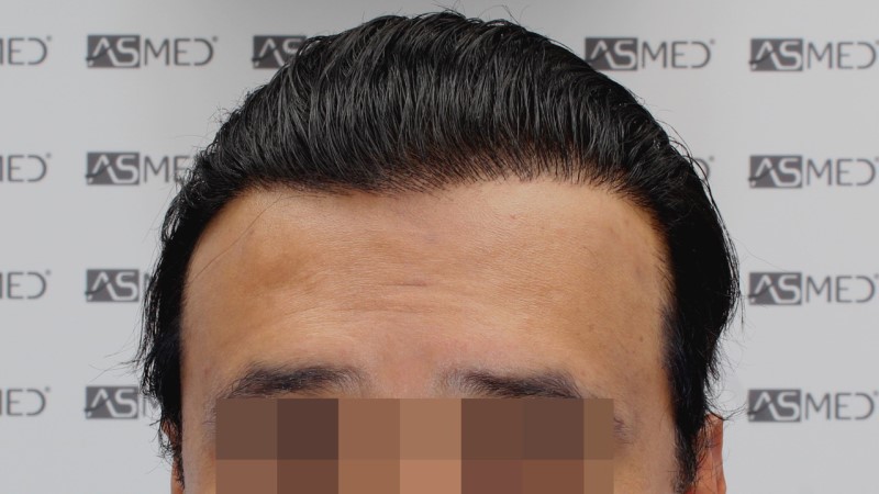 Patient Result