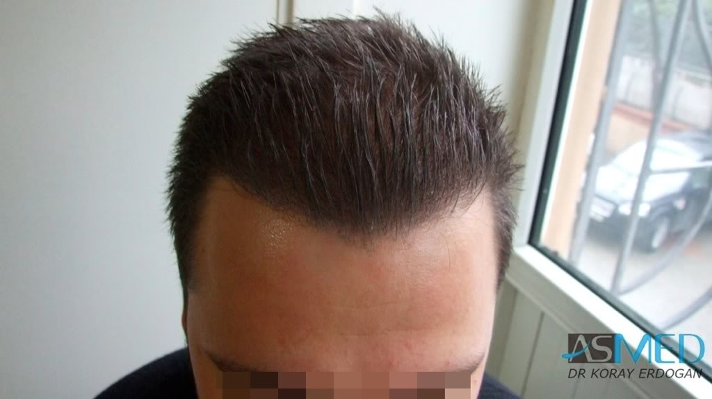 Patient Result