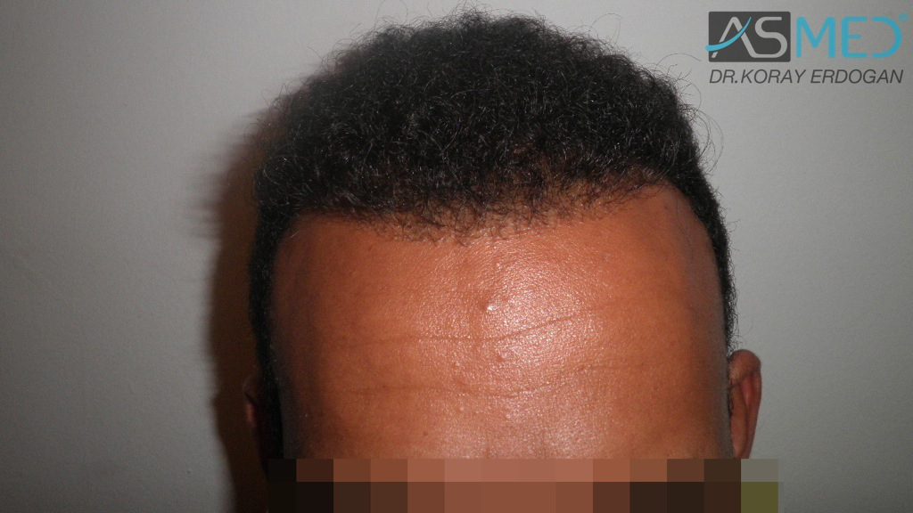 Patient Result
