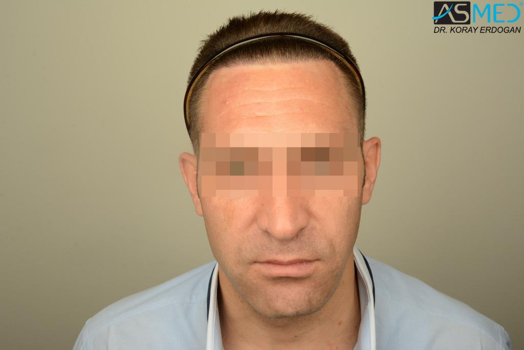 Patient Result
