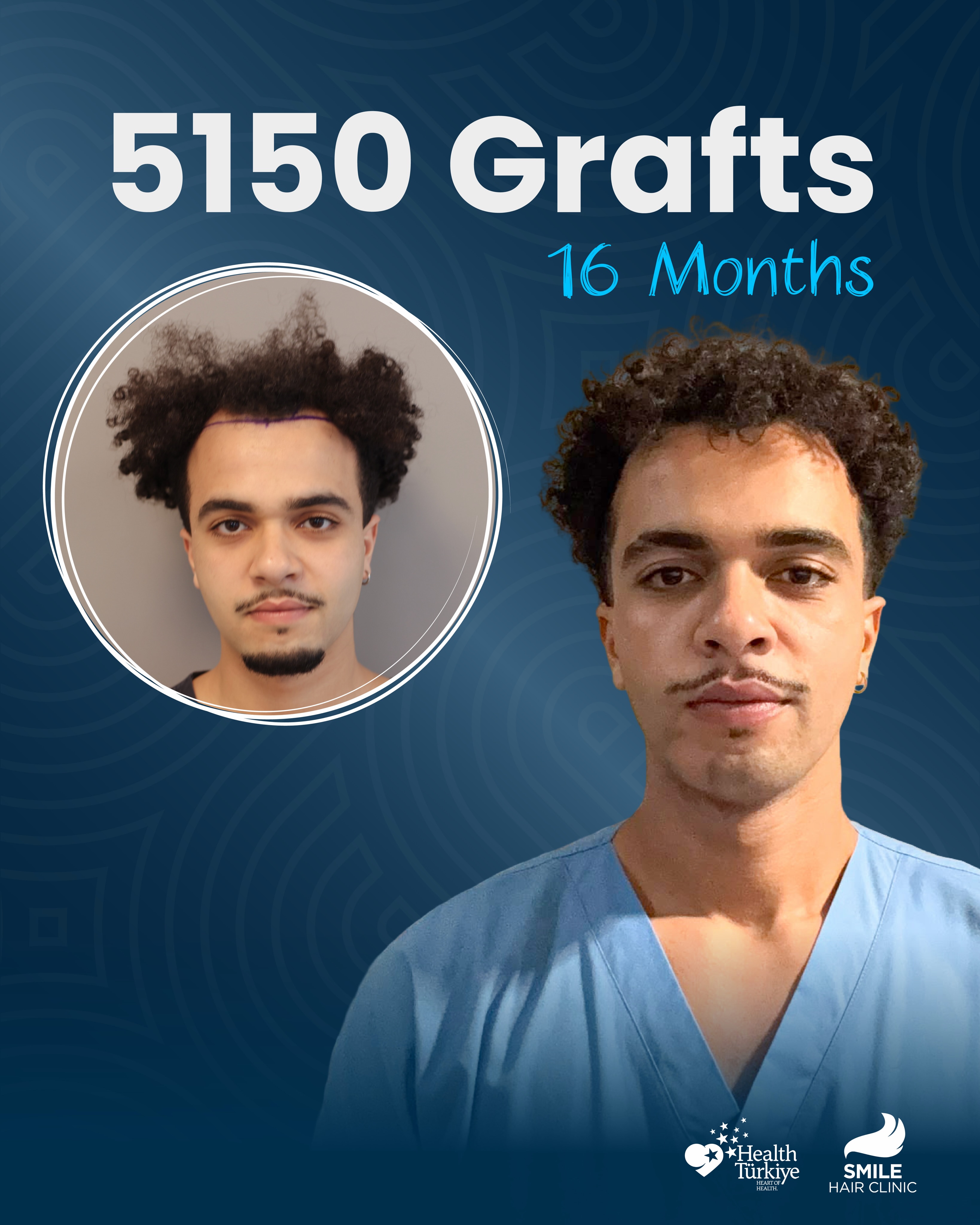 Before and After  graft    transplant at 